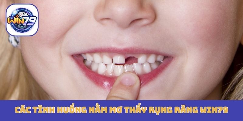 Các tình huống nằm mơ thấy rụng răng Win79