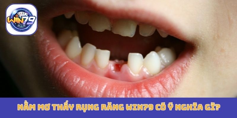 Nằm mơ thấy rụng răng Win79 có ý nghĩa gì?
