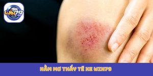 nằm mơ thấy té xe Win79